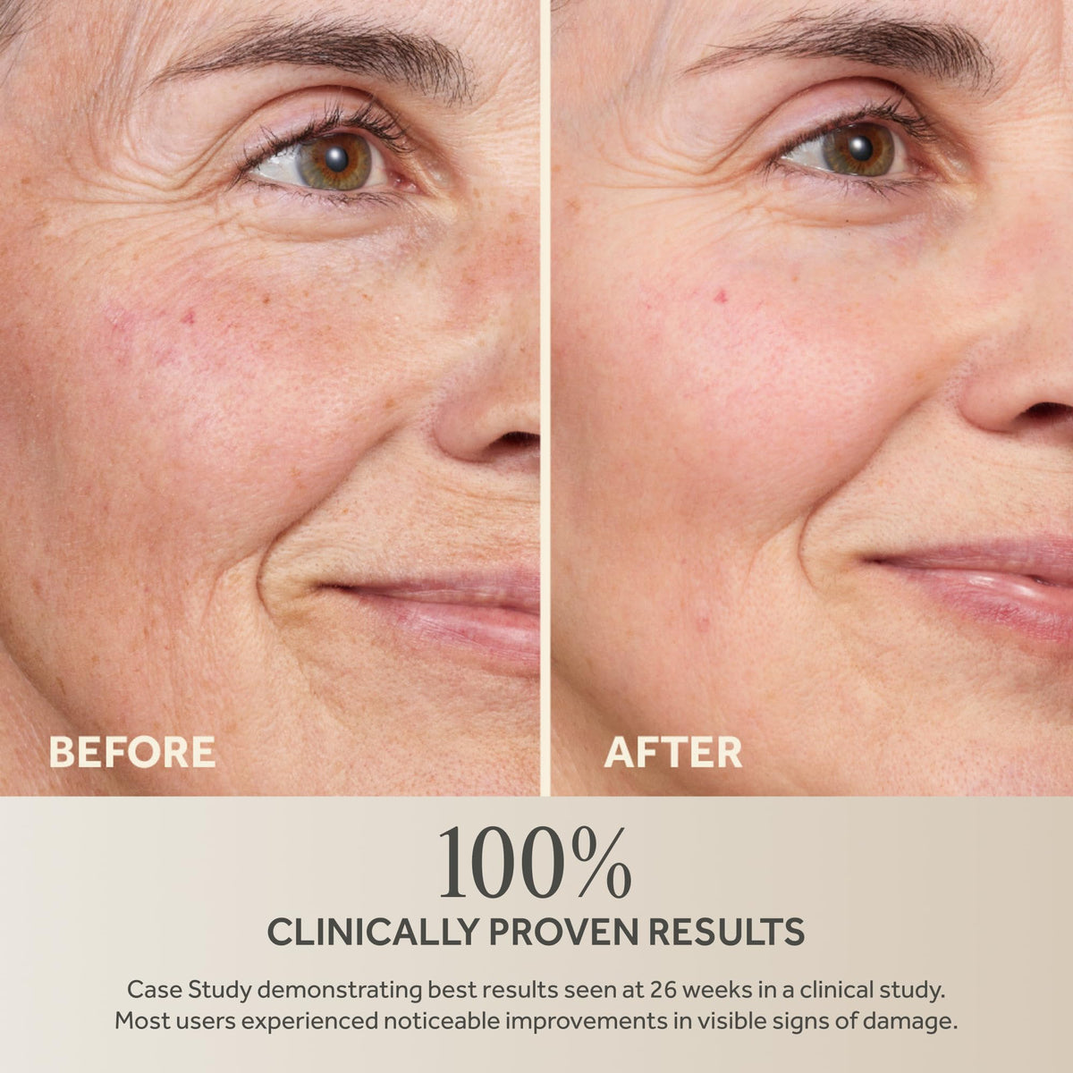 No7 peptide complex ingredient focus showcasing advanced repair technology benefits