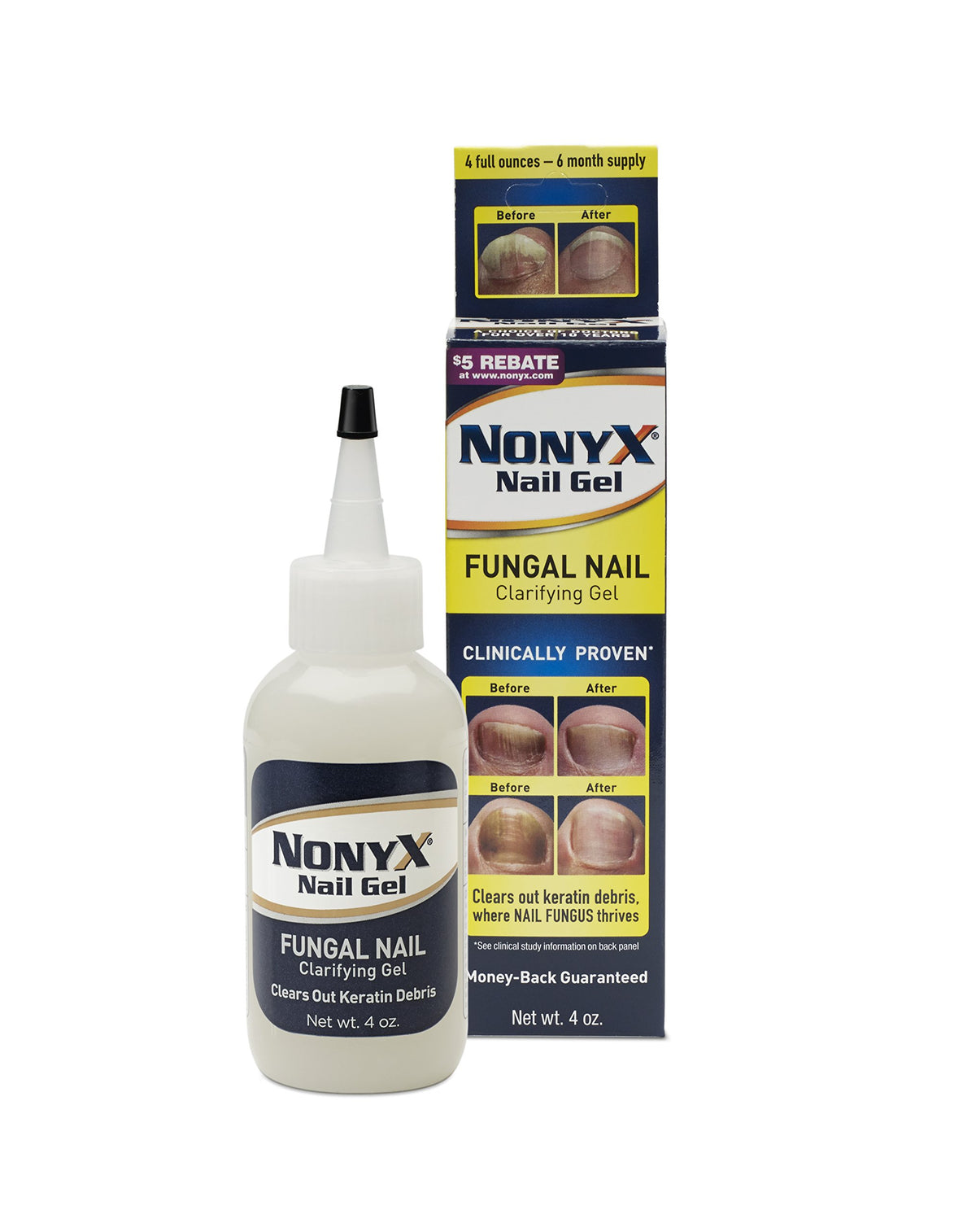 NonyX nail gel front packaging shows tube and clear results for improved nail appearance