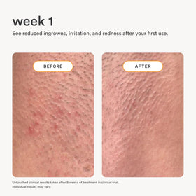 Nood serum staged in bathroom lifestyle scene conveying daily routine ease