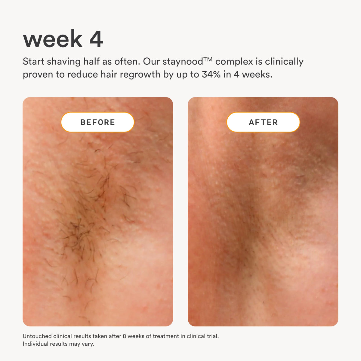 Nood serum held in hand for size comparison and travel-friendly convenience