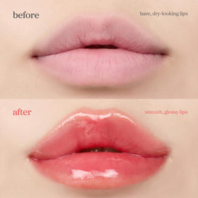 NOONI Appleberry before and after lips displaying smoother, fuller-looking results