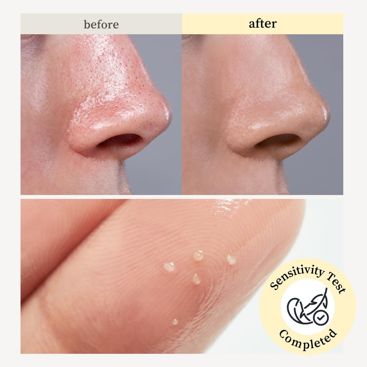 NOONI before and after pores image highlighting clearer pores and refined texture