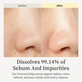 NOONI oil texture close-up illustrating silky consistency for gentle makeup breakdown