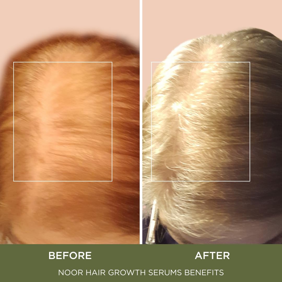 NOOR HAIR ingredient collage with coffee bean and cynatine showing nourishing blend