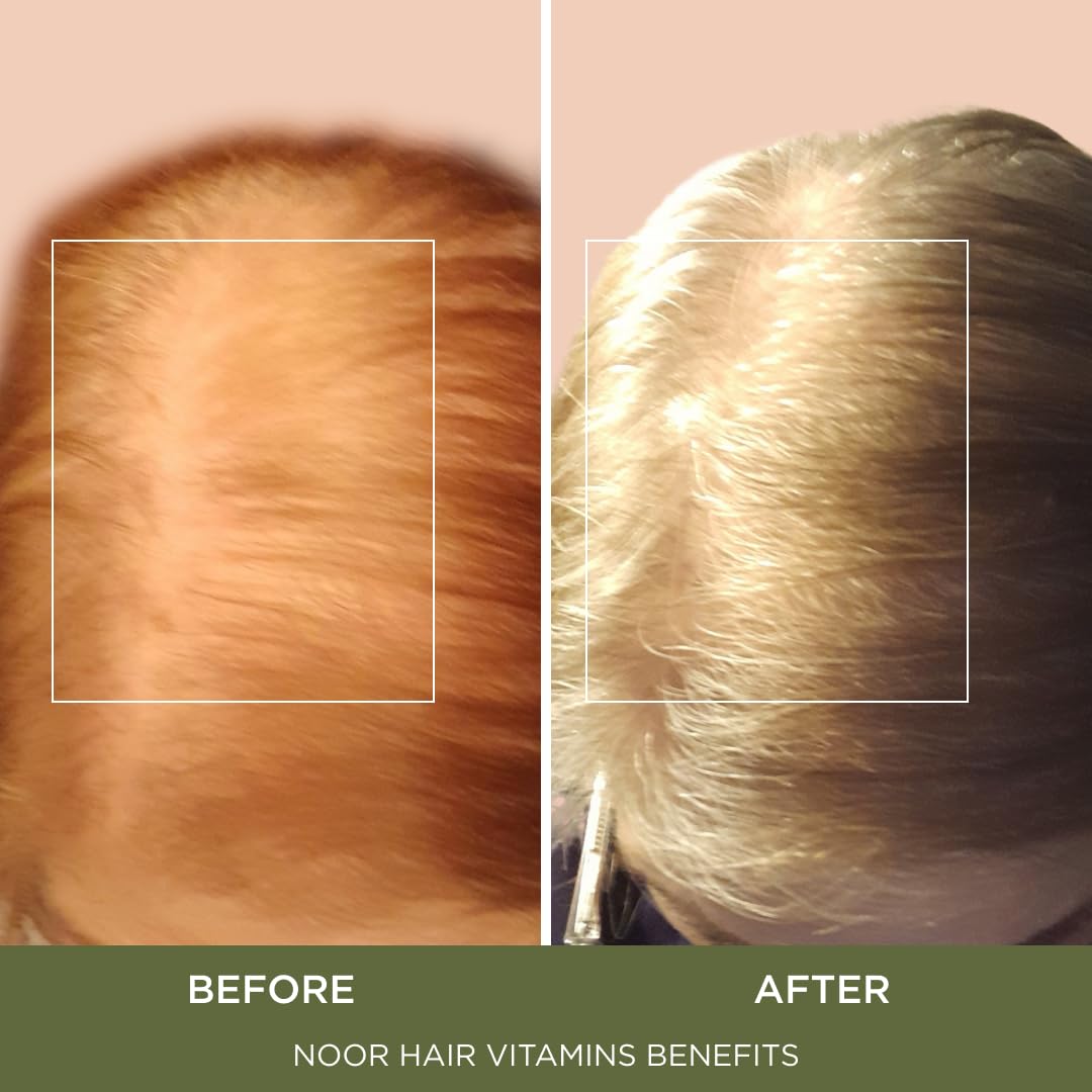 NOOR HAIR supplement label ingredient panel, helps verify nutrient transparency