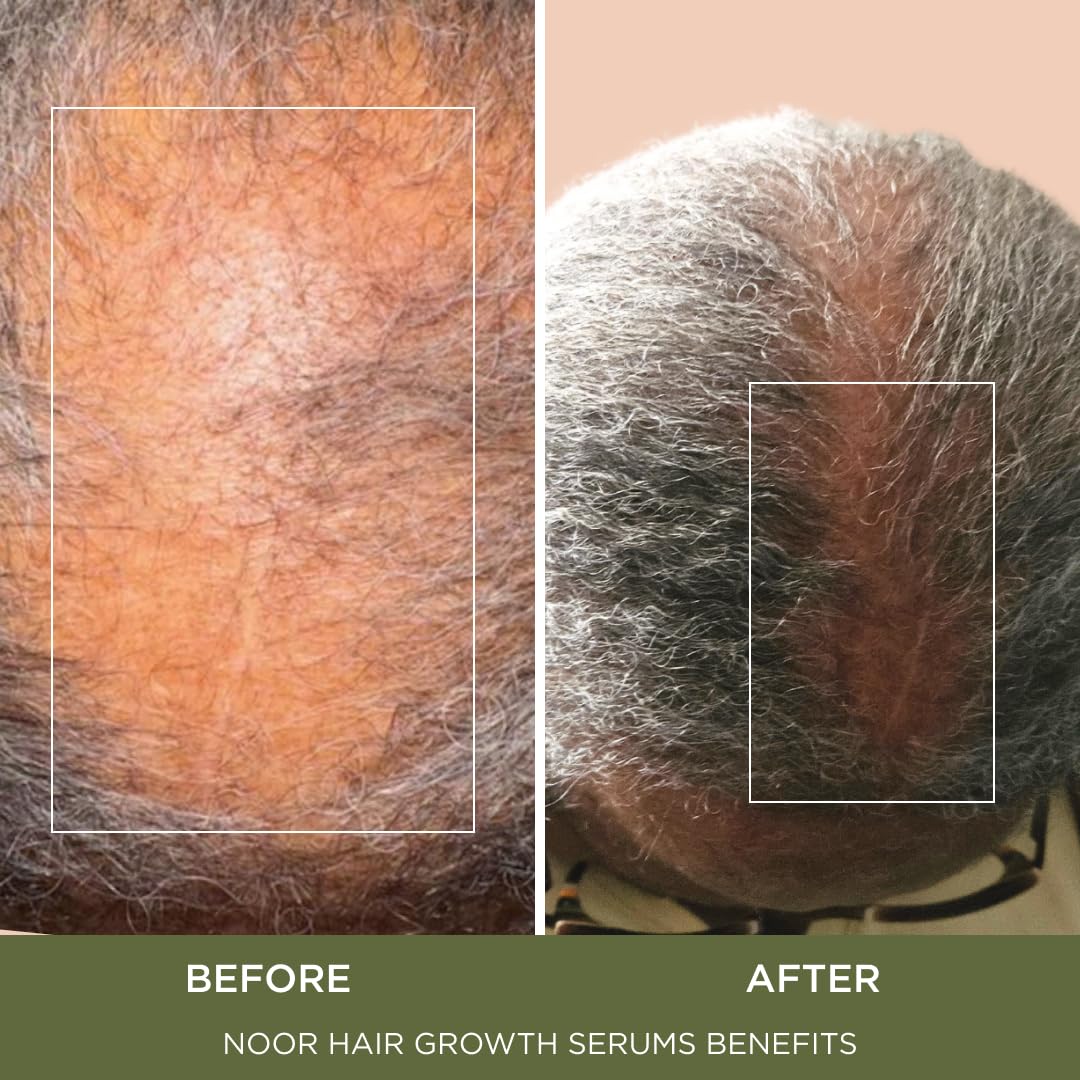 NOOR HAIR ginkgo biloba leaf close-up highlighting circulation support