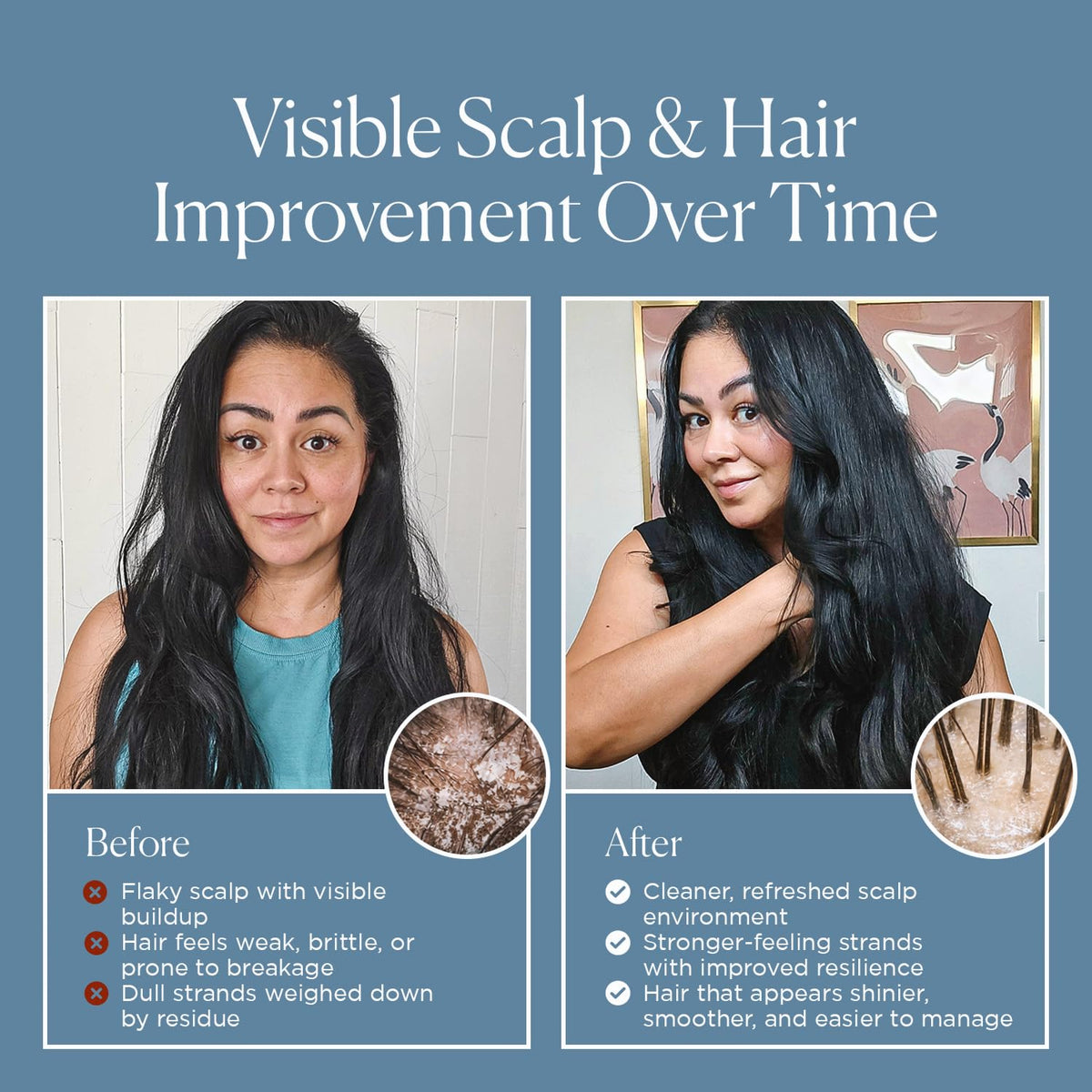Nora Ross rosemary and garlic botanicals highlighting natural support