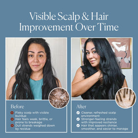 Nora Ross rosemary and garlic botanicals highlighting natural support