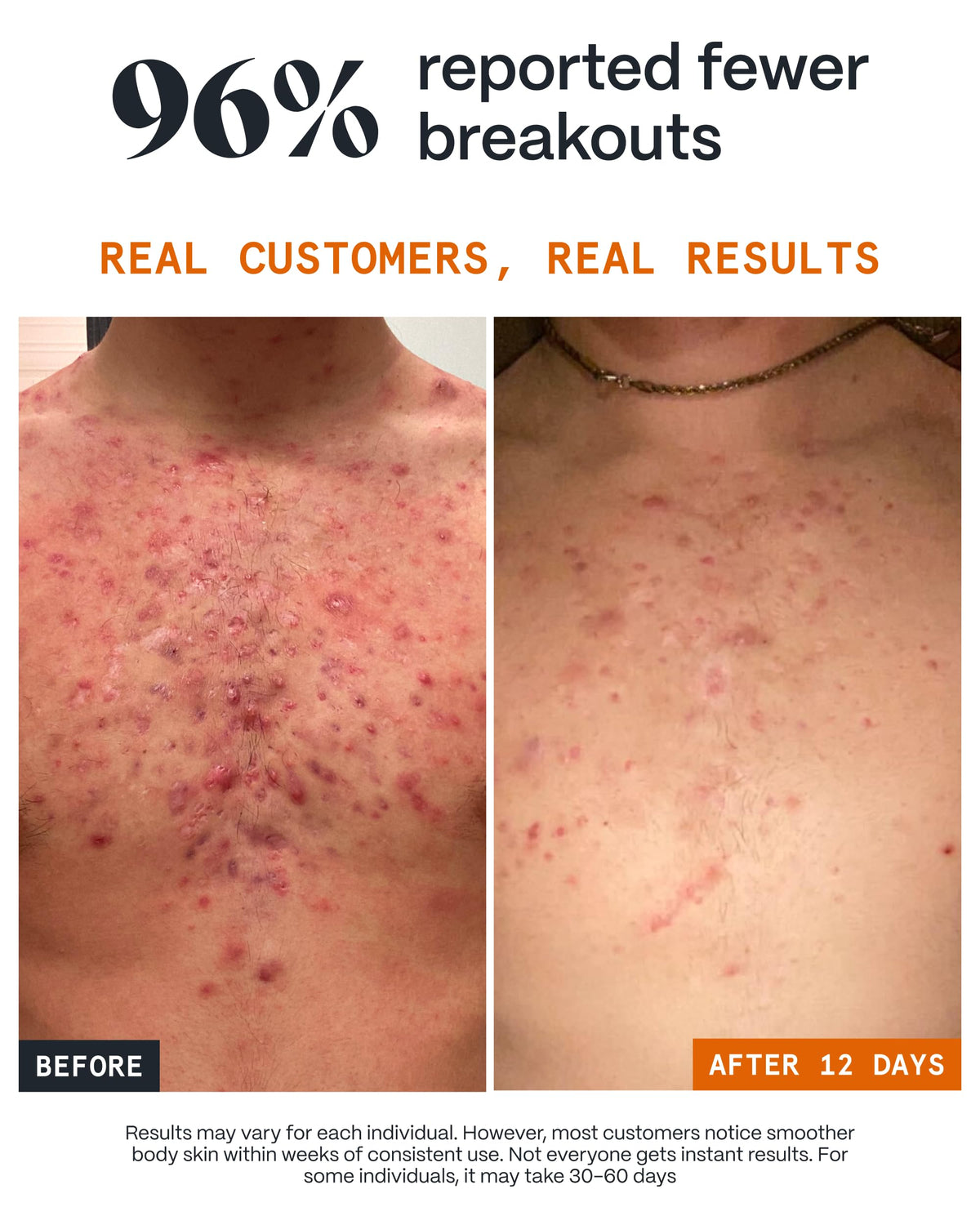 Norse Organics being applied to back with hands demonstrating targeted use