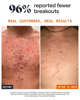 Norse Organics being applied to back with hands demonstrating targeted use