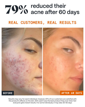 Norse Organics Scar Healer application with fingertip showing targeted improvement