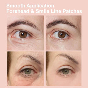 NOVALIFT smile line and forehead patch placement showing wrinkle-targeting benefit