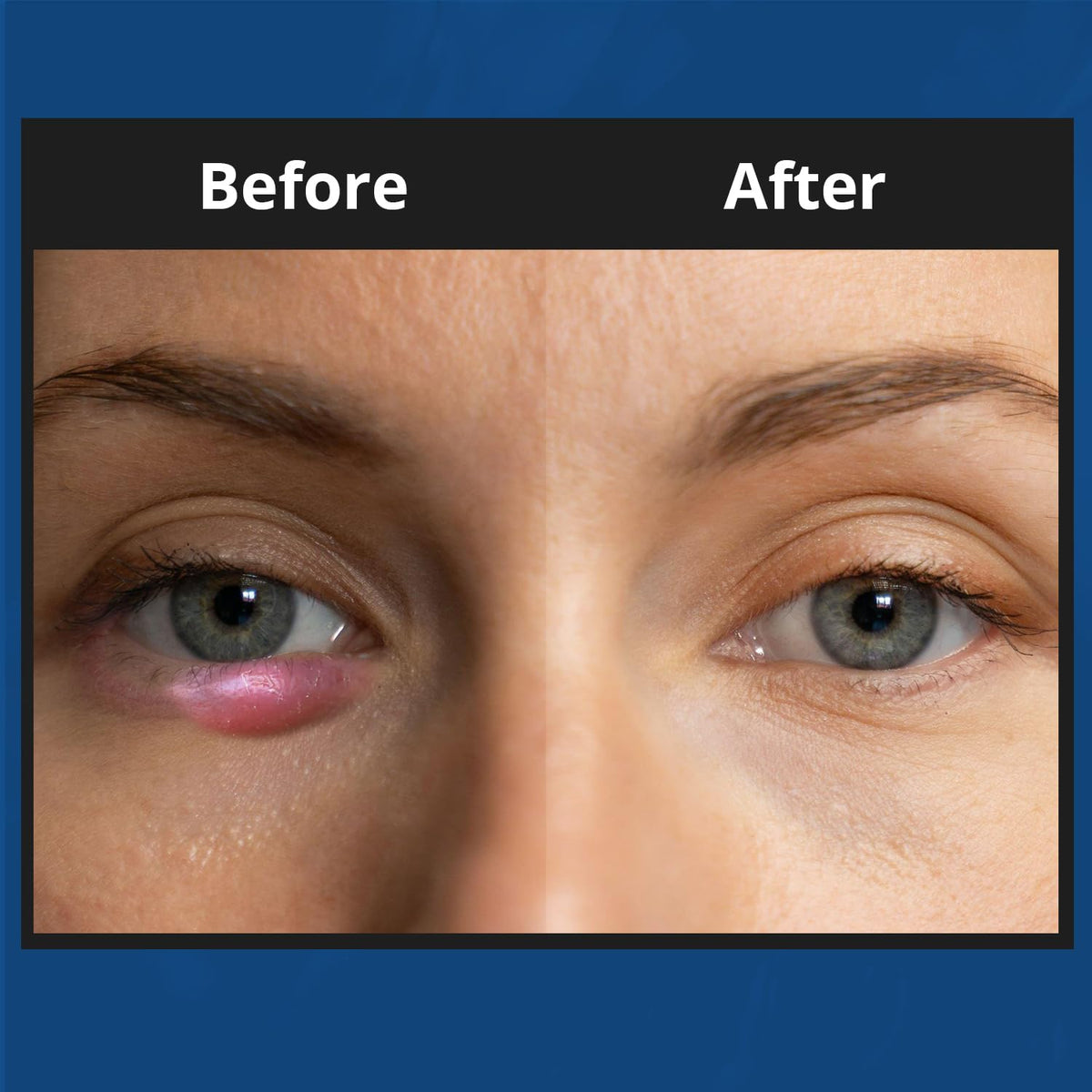 NOVEHA application on fingertip demonstrating controlled dosing and soft spread