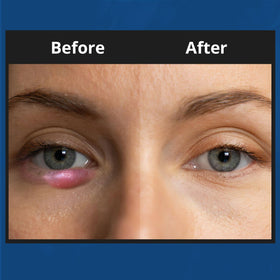 NOVEHA application on fingertip demonstrating controlled dosing and soft spread