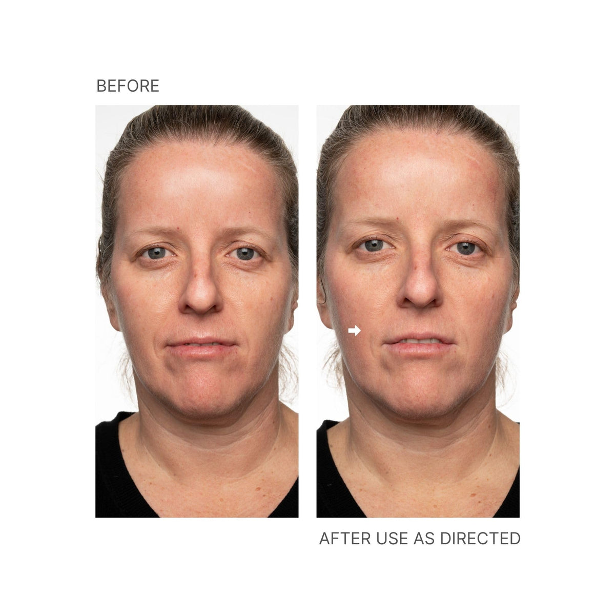 Nu Skin used on neck and décolleté showing evened tone benefit