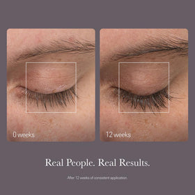 NULASTIN being applied to upper lash line demonstrating safe use