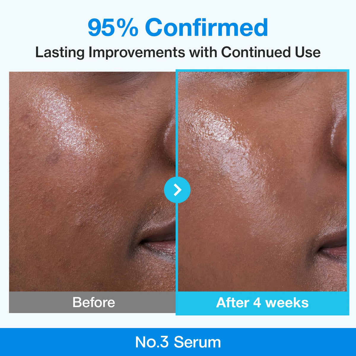 numbuzin ingredients label showing blue retinol and niacinamide benefits