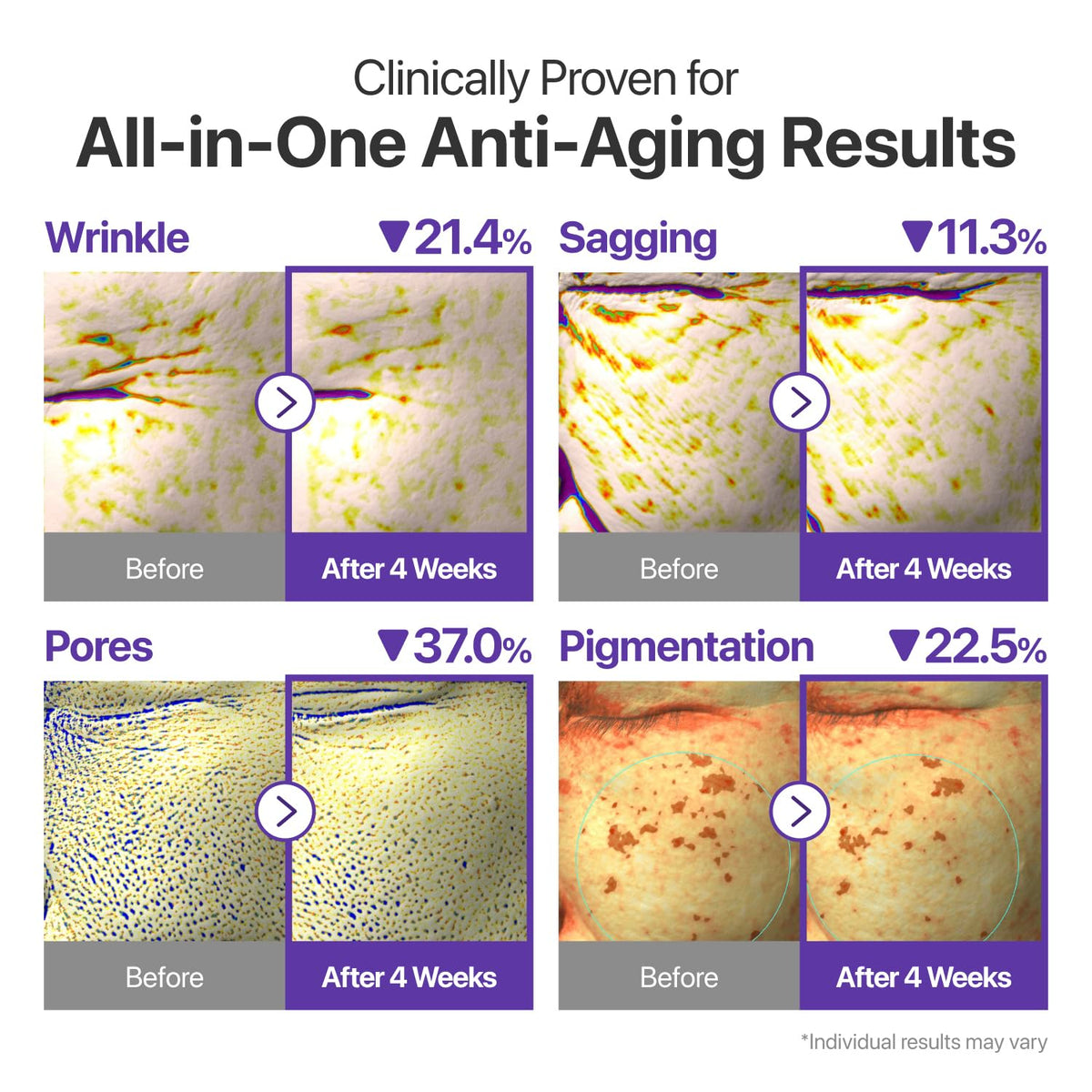 numbuzin liposome capsule visual emphasizing enhanced retinal delivery benefits