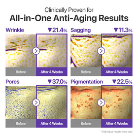 numbuzin liposome capsule visual emphasizing enhanced retinal delivery benefits