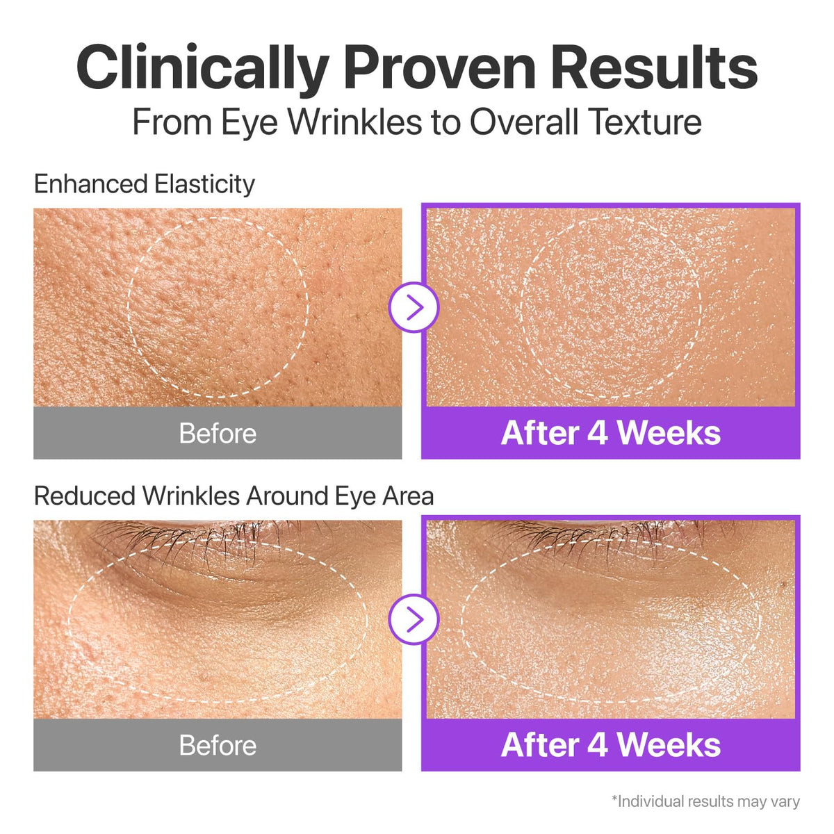 numbuzin neck demonstration showing firming application benefit
