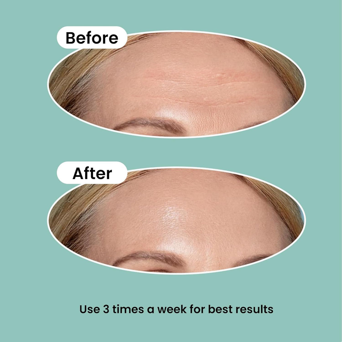 NURIVE ingredients display highlighting retinol and collagen for surface renewal