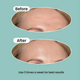 NURIVE ingredients display highlighting retinol and collagen for surface renewal
