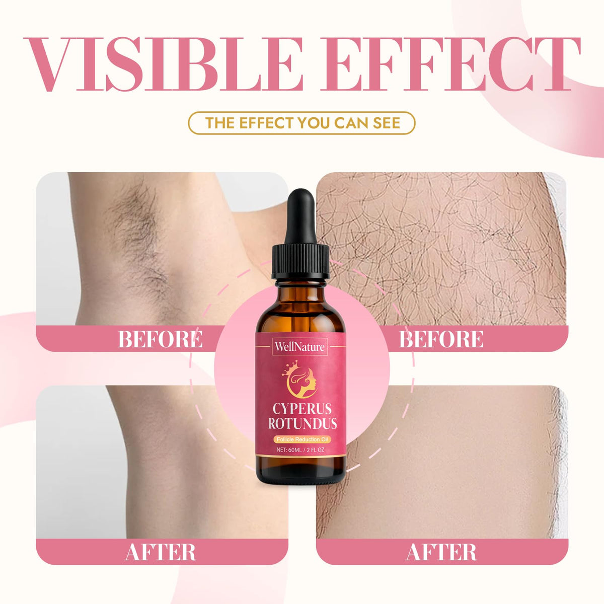 nutramd WellNature legs before and after visual scale to show smoother skin over time