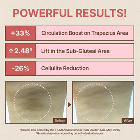 nutseline applicator used along jawline for sculpting and contouring benefit