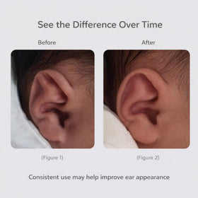 Nutvrliy side profile fit demonstrating molded clip holding ear closer