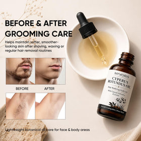 NYVORIS application on leg after shaving to soothe and hydrate