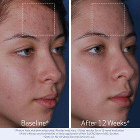 Obagi Medical cleanser and toner staged together showing streamlined routine