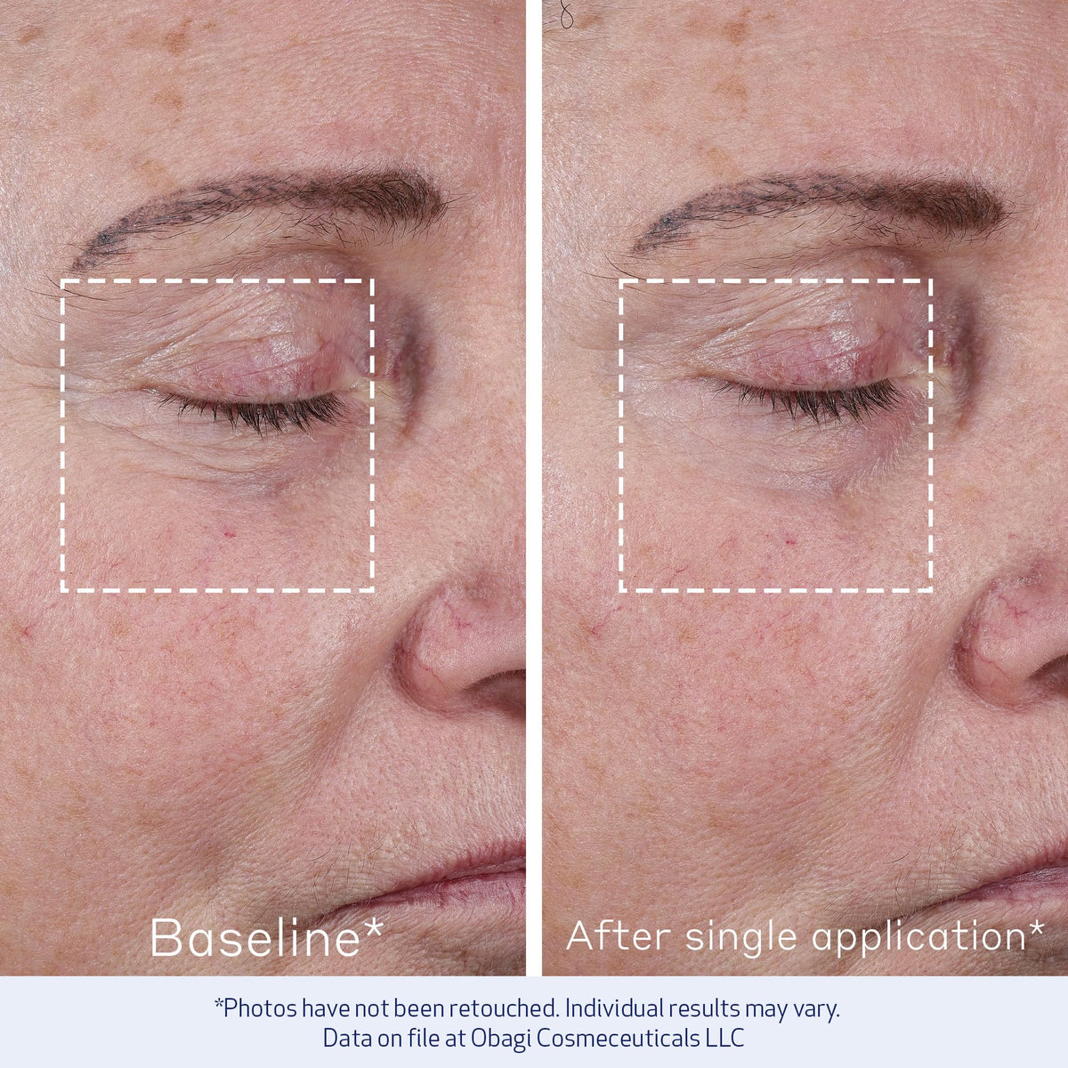Obagi ELASTIderm applied on hand to show texture and immediate smoothing benefit