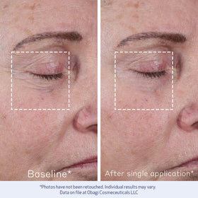 Obagi ELASTIderm applied on hand to show texture and immediate smoothing benefit