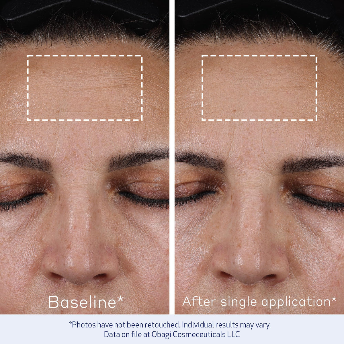 Obagi ELASTIderm bottle staged with other skincare for layering and routine benefit