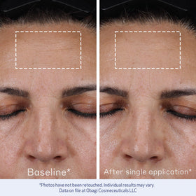 Obagi ELASTIderm bottle staged with other skincare for layering and routine benefit