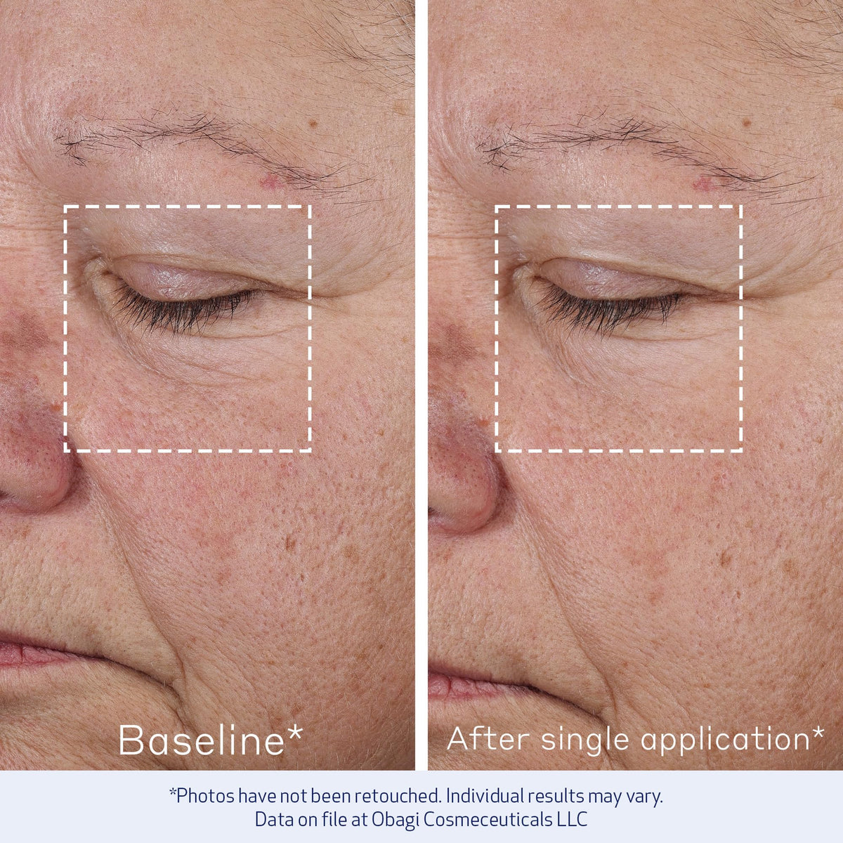 Obagi ELASTIderm closeup label highlighting ingredient technology and clinical testing