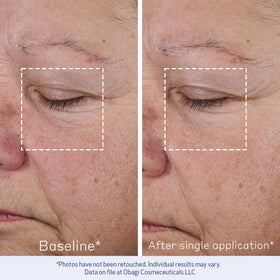 Obagi ELASTIderm closeup label highlighting ingredient technology and clinical testing