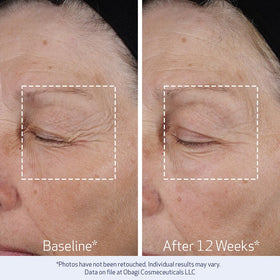 Obagi ELASTIderm cream on fingers demonstrating smooth application and hydration