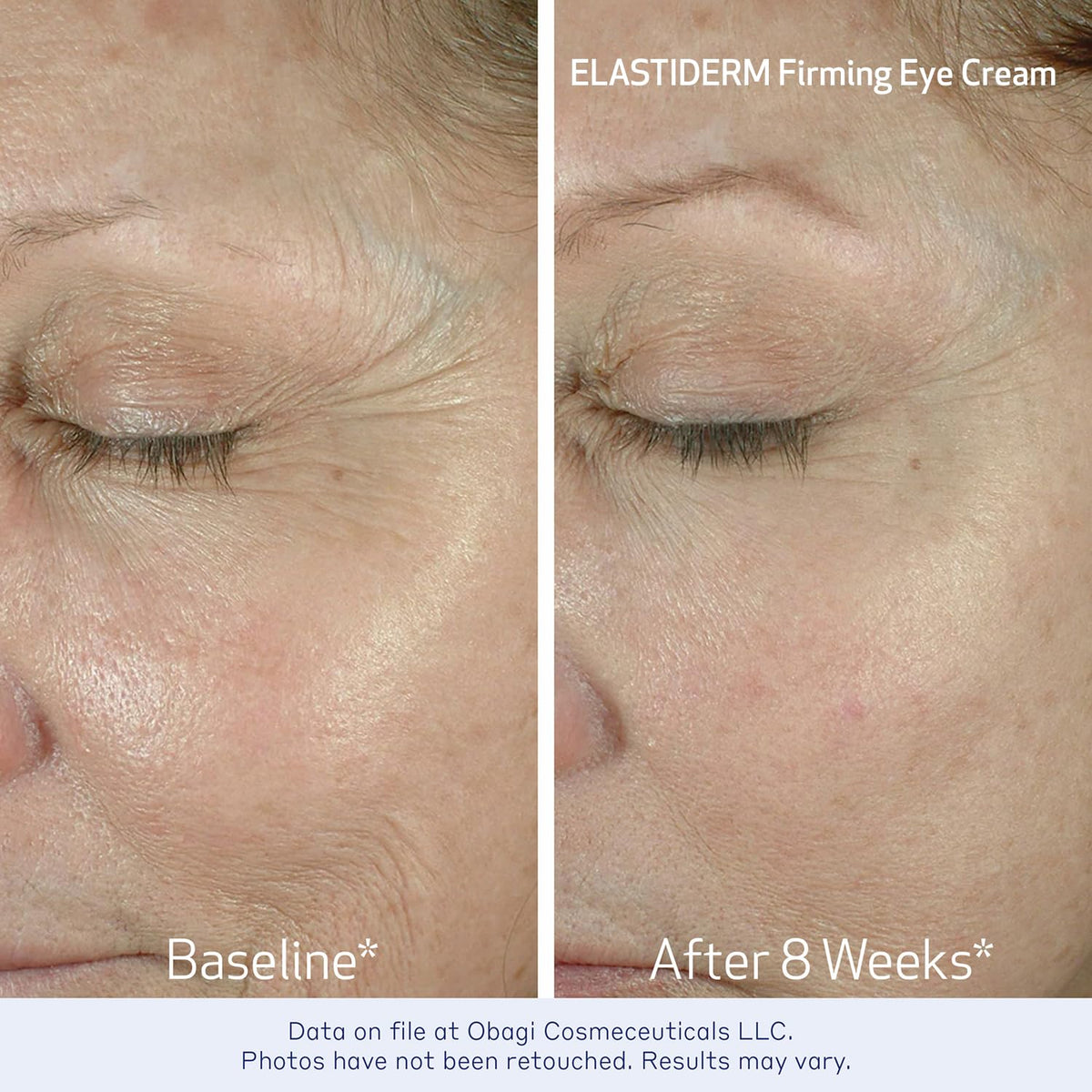 Obagi ELASTIDERM eye cream tube detail illustrating lightweight formula