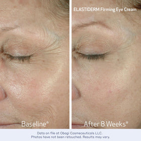 Obagi ELASTIDERM eye cream tube detail illustrating lightweight formula