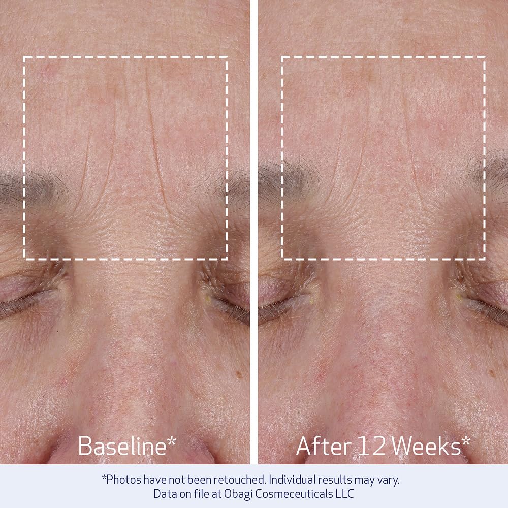 Obagi ELASTIderm ingredient complex graphic showing minerals and peptide benefits