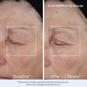 Obagi ELASTIDERM label showing Bi‑Mineral Contour Complex technology