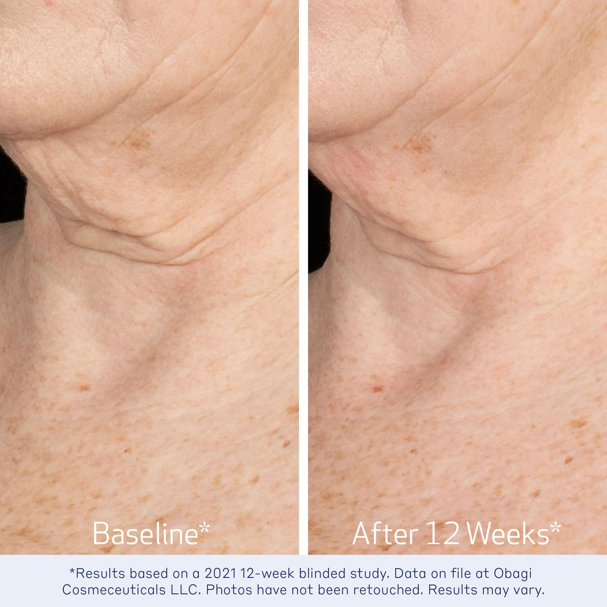 Obagi Medical label close-up highlighting key ingredients and benefits