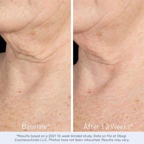 Obagi Medical label close-up highlighting key ingredients and benefits