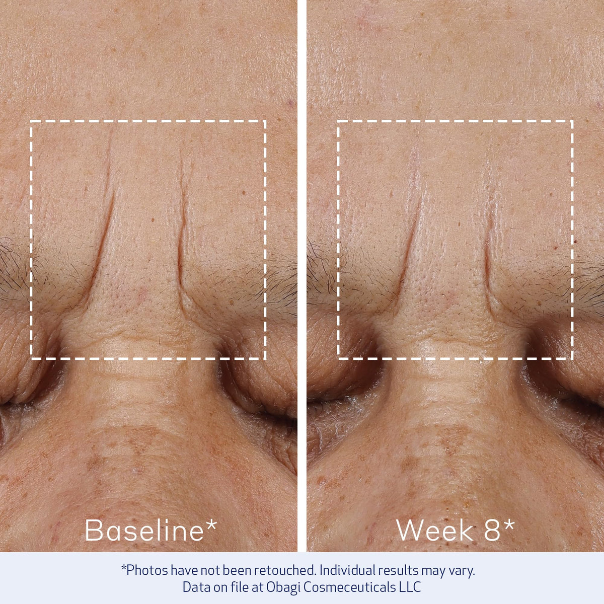 Obagi ELASTIderm size comparison with common items showing compact 0.68 oz benefit