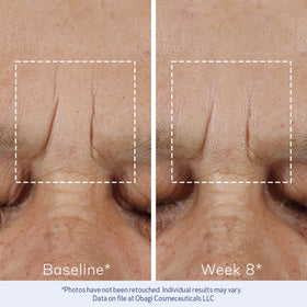 Obagi ELASTIderm size comparison with common items showing compact 0.68 oz benefit