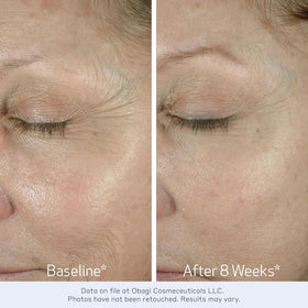 Obagi Medical side label highlighting ingredients and formulation benefits