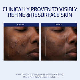 Obagi Medical before-and-after skin texture comparison showing improvement