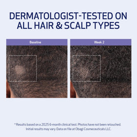 Obagi Nu-Cil application parting hair to target the scalp for even distribution