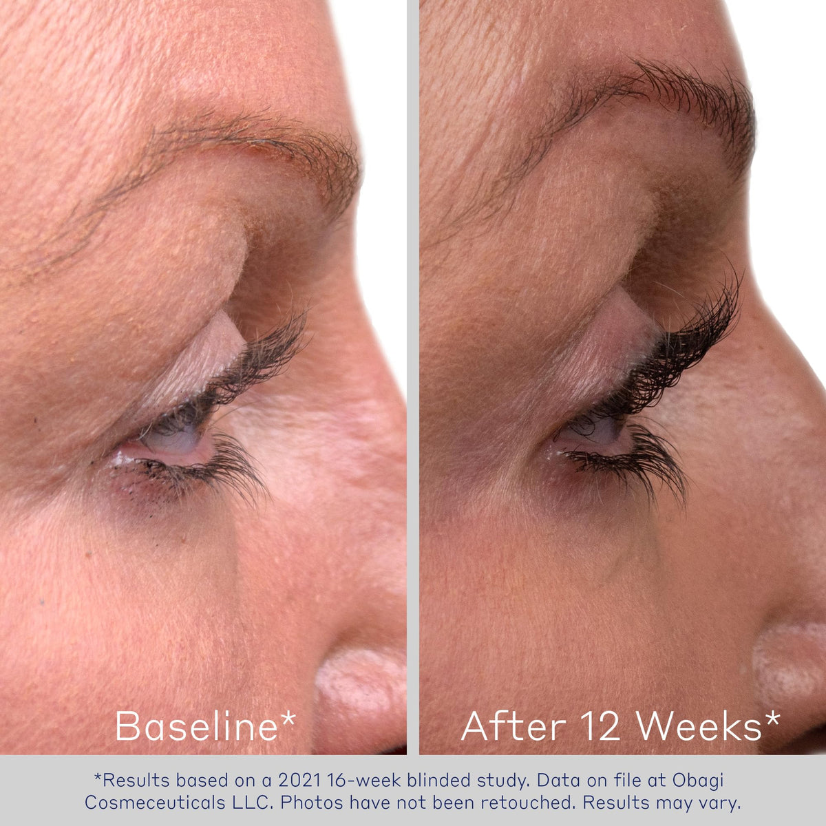 Visual ingredients of Obagi Nu-Cil highlighting biotin and panthenol conditioning benefits